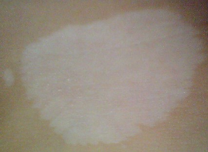 引发儿童白癜风原因都有哪些 引发儿童白癜风原因都有哪些.jpg